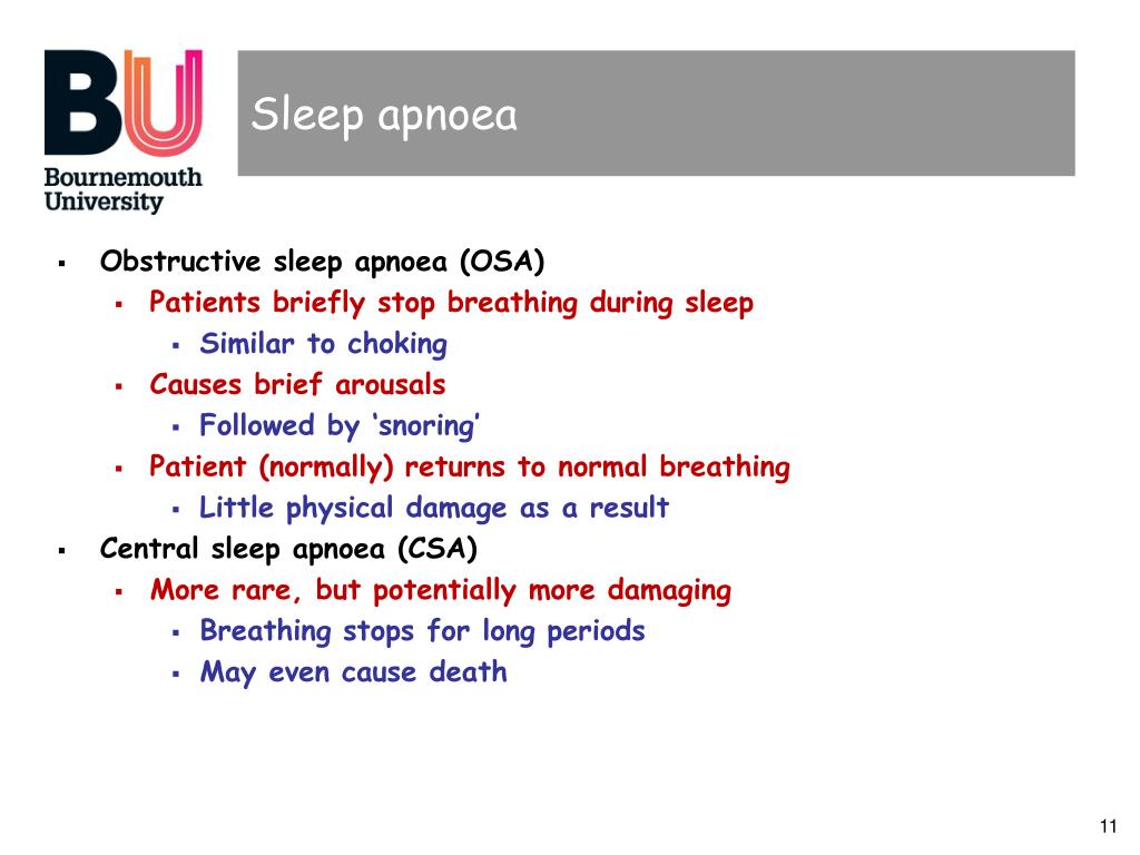 mild narcolepsy without cataplexy mild narcolepsy without cataplexy