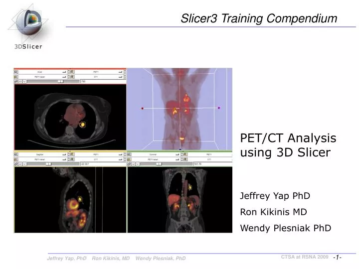 PPT - PET/CT Analysis using 3D Slicer PowerPoint Presentation, free ...