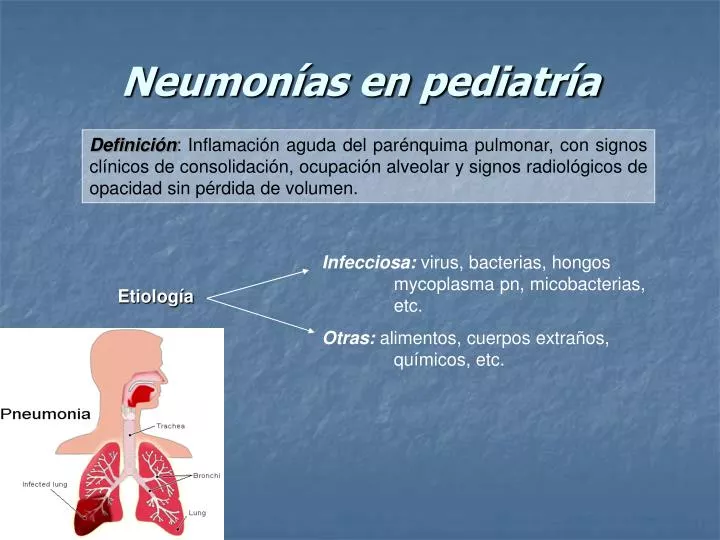 PPT - Neumonías en pediatría PowerPoint Presentation, free download ...