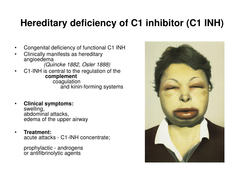 Ppt Immune Response And Hormonal Alterations In C1 Inhibitor Deficiency Powerpoint 8201