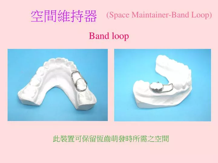 PPT (Space MaintainerBand Loop) PowerPoint Presentation, free