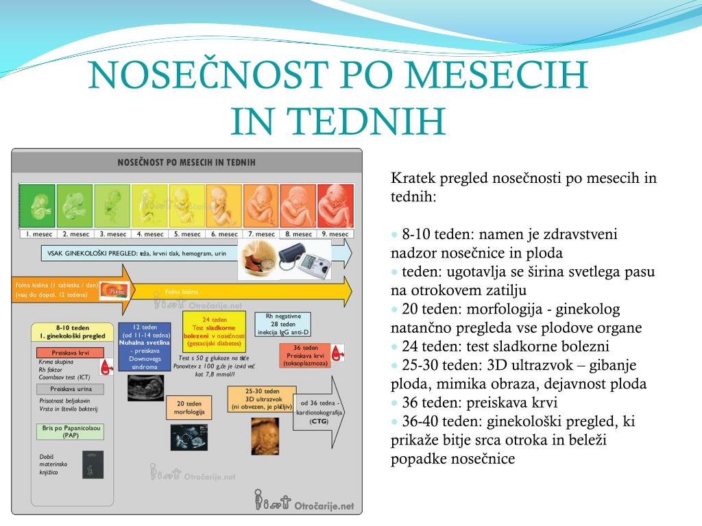 PPT - NOSEČNOST PowerPoint Presentation, free download - ID:4037056