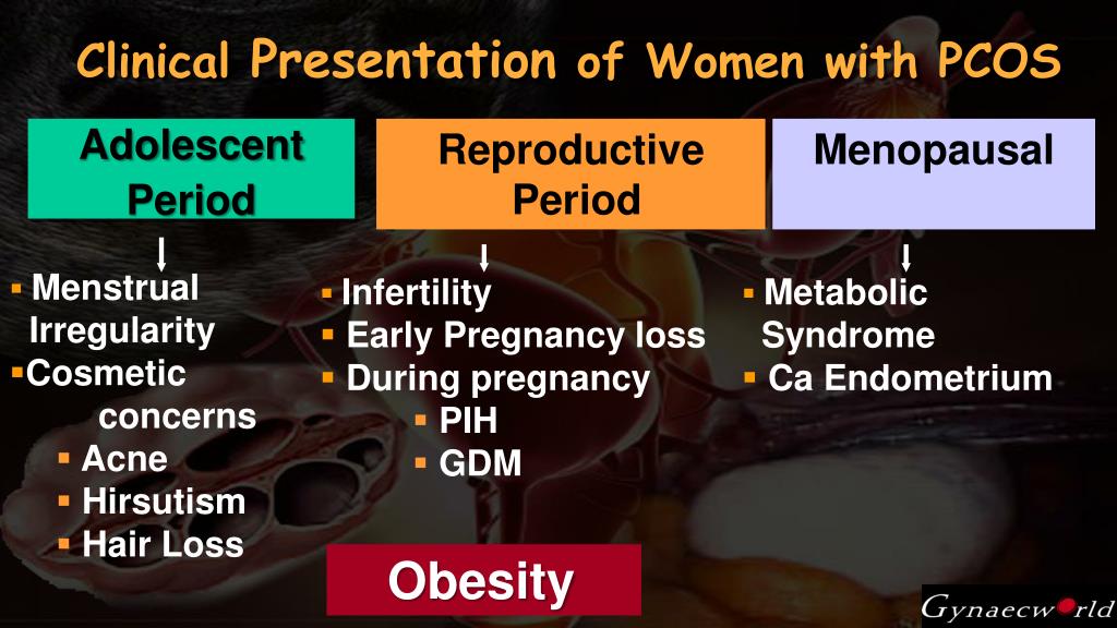 powerpoint presentation on pcos