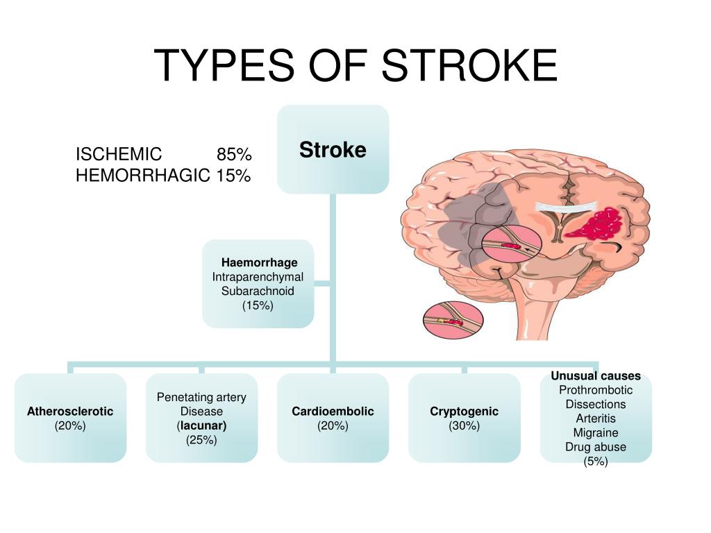 clinical presentations of stroke