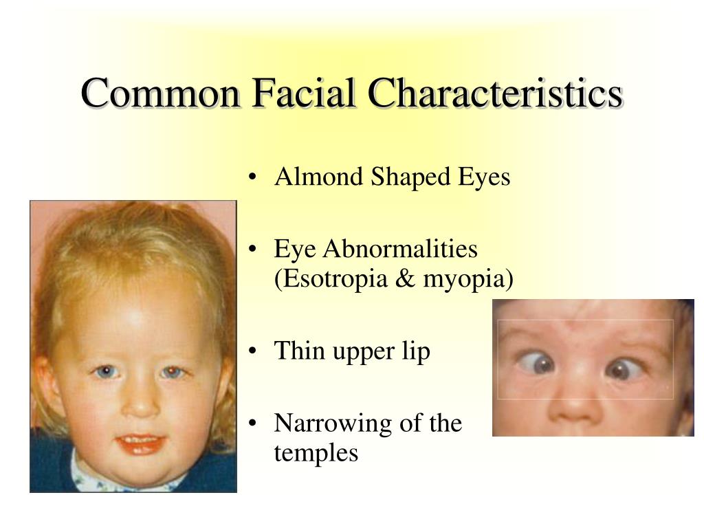 PPT Behavior Characteristics of Prader Willi Syndrome Cindy Stolp PowerPoint Presentation ID