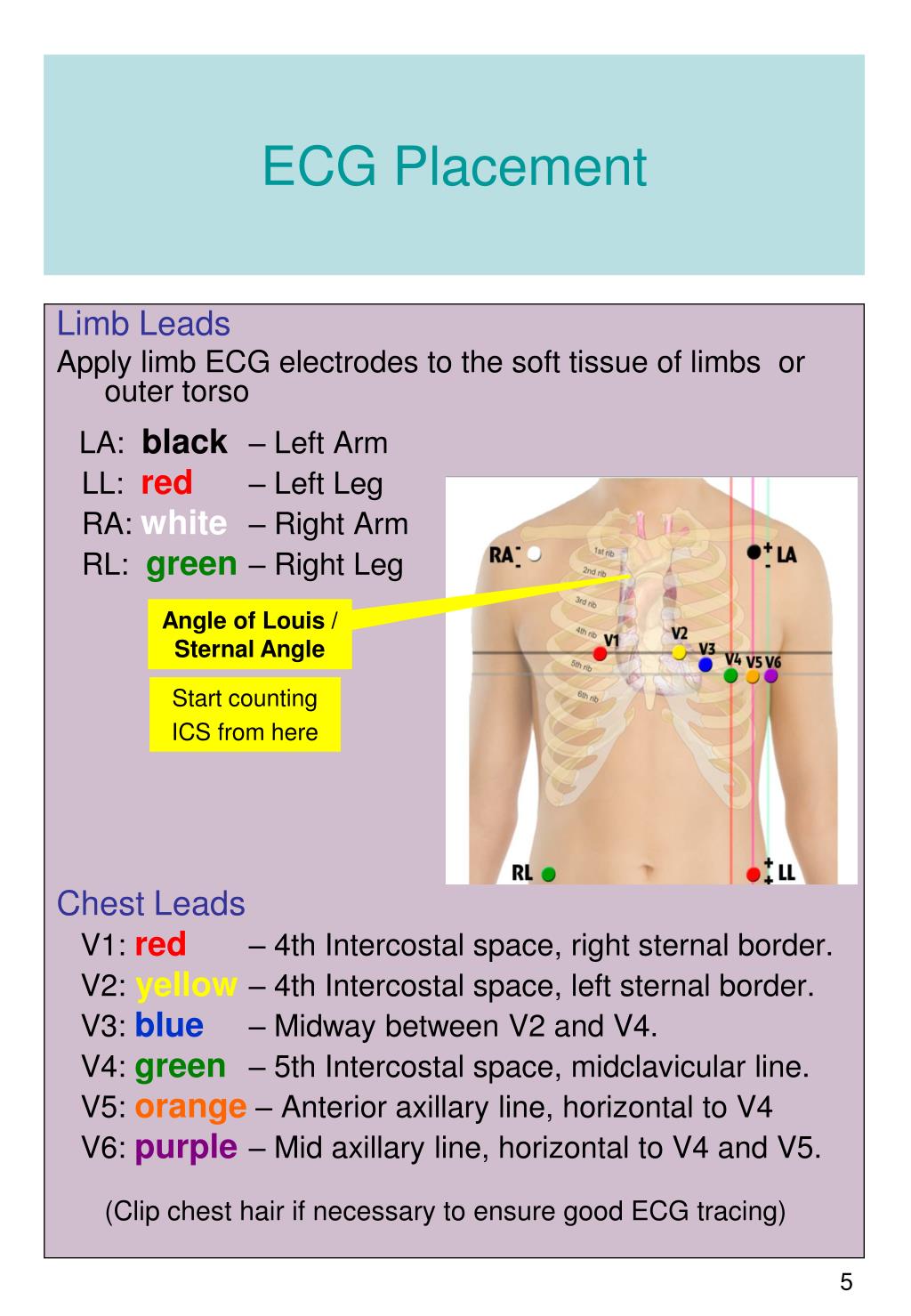 Ecg Placement Guide