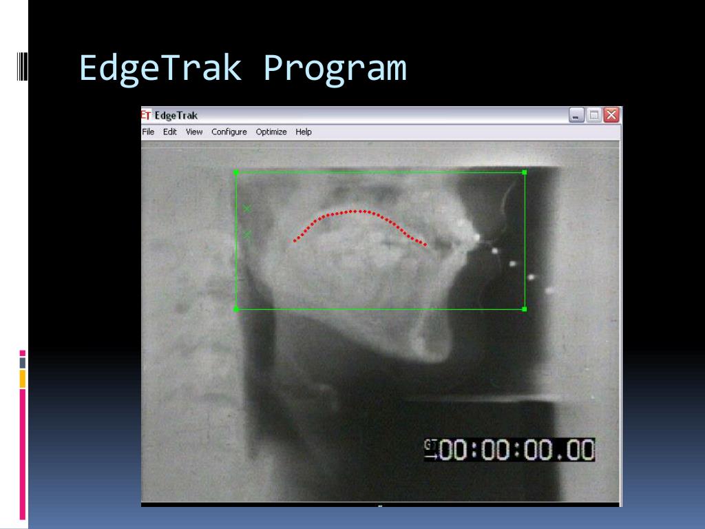 Rulo Edgetrak Controller PPT - Image Processing Algorithm for Speech Acoustics PowerPoint ...