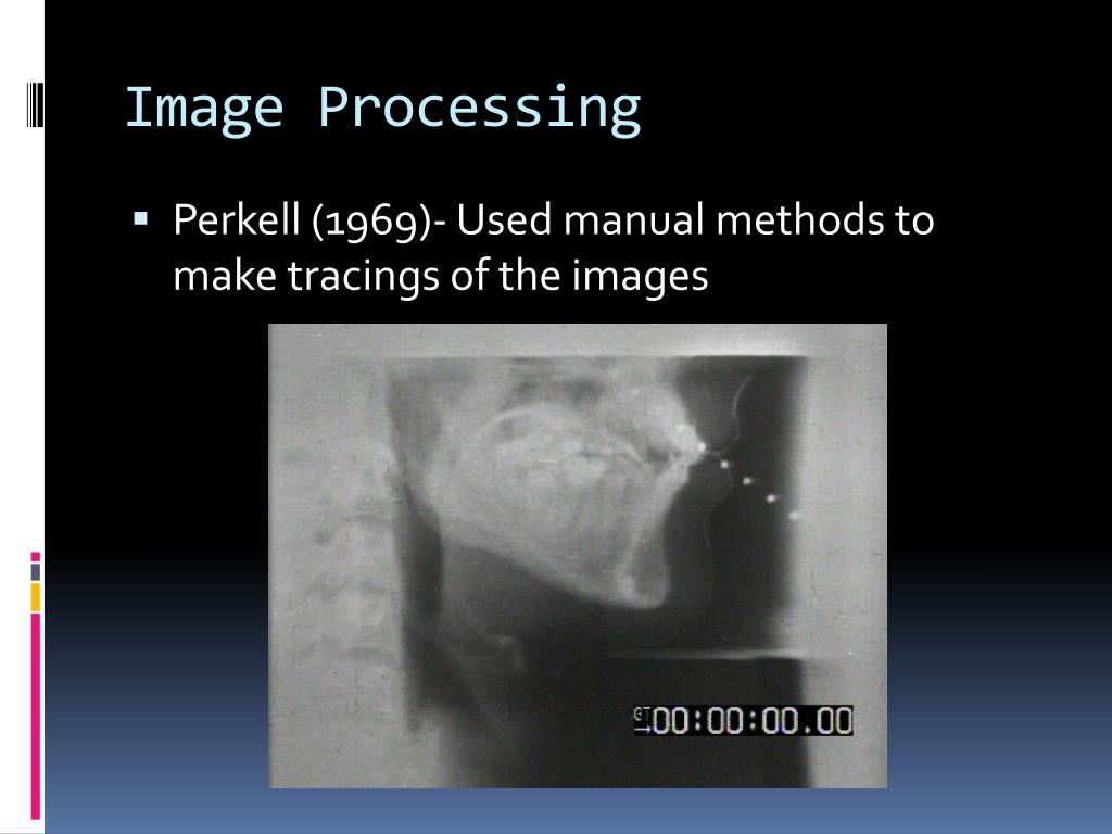 PPT - Image Processing Algorithm for Speech Acoustics PowerPoint ...