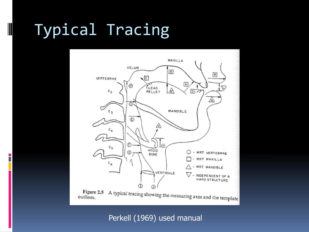 PPT - Image Processing Algorithm for Speech Acoustics PowerPoint ...