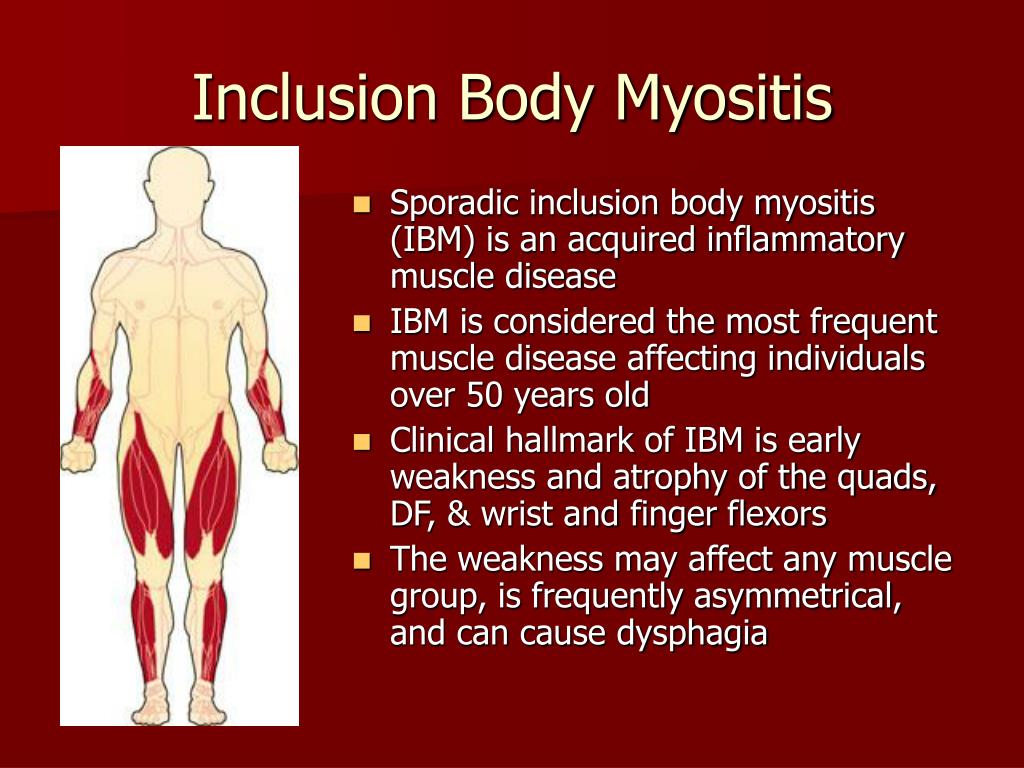 PPT Inclusion Body Myositis PowerPoint Presentation, free download