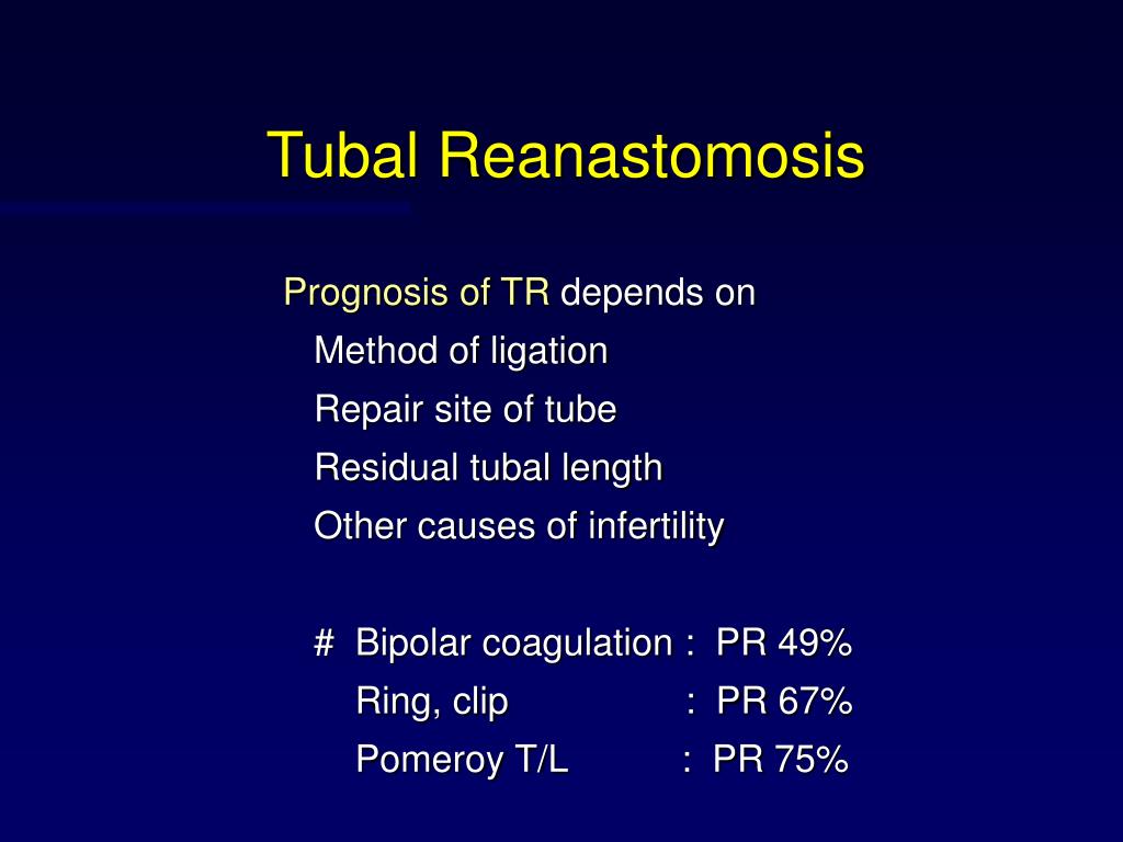 PPT - Tuboplasty vs. IVF - ET PowerPoint Presentation, free download ...