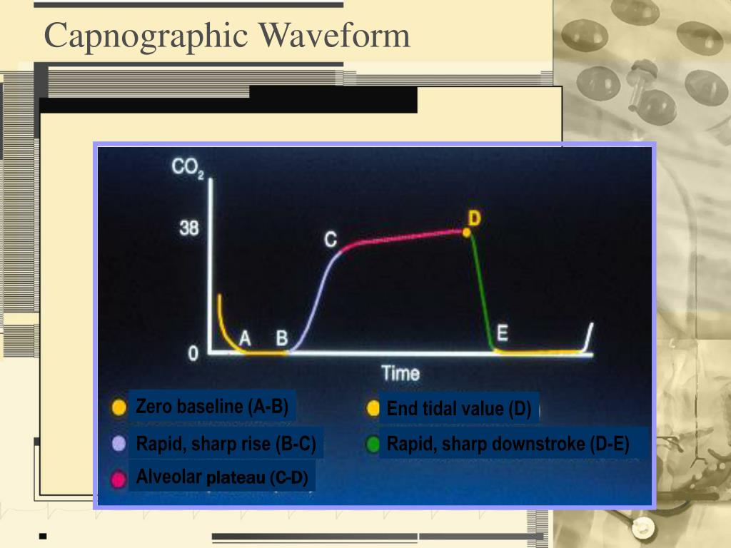 capnography waveform ems powerpoint ppt normal end co2 tidal levels exhalation beginning capnogram presentation slideserve