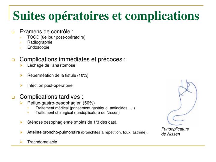 Atresie De Loesophage Esperance De Vie Atrésie De L'oesophage Esperance De Vie - Communauté MCMS