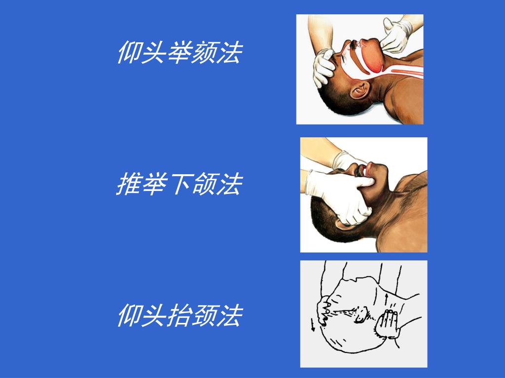 PPT - C P R 现场心肺复苏术 PowerPoint Presentation, free download - ID:5124904