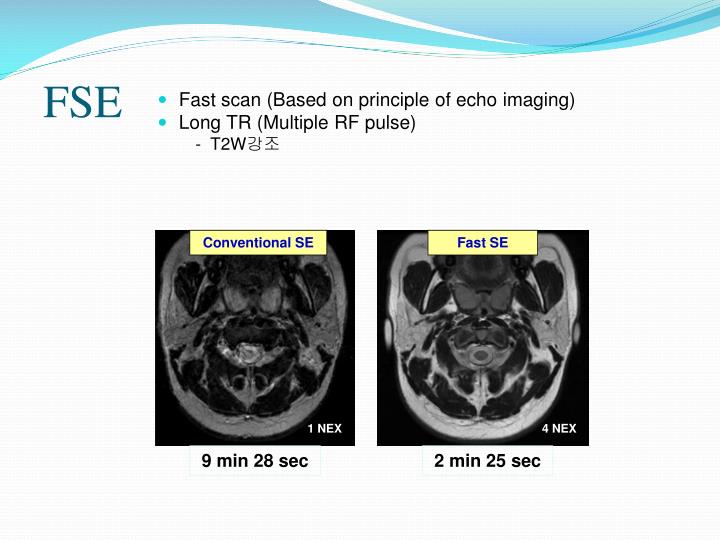 PPT - FAST SPIN ECHO PowerPoint Presentation - ID:4091180