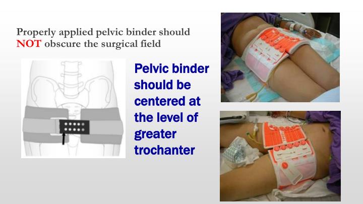 PPT - Fracture Pelvis PowerPoint Presentation - ID:4091721