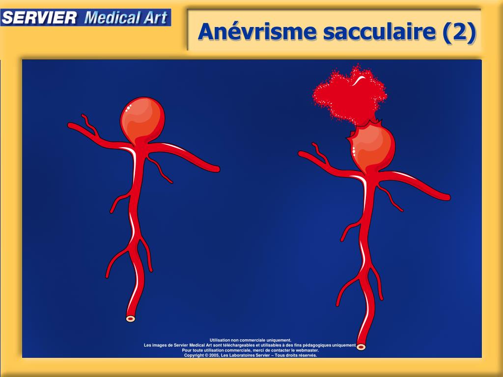 PPT - Artères - physiopathologie PowerPoint Presentation, free download ...