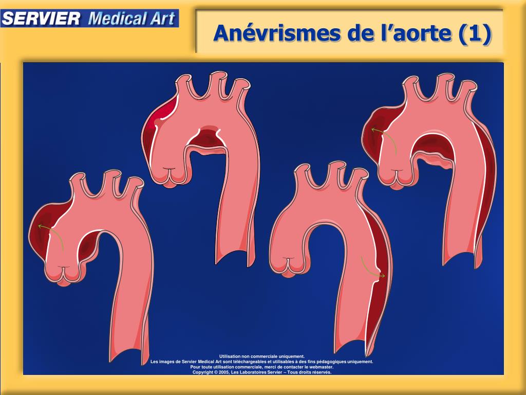 PPT - Artères - physiopathologie PowerPoint Presentation, free download ...