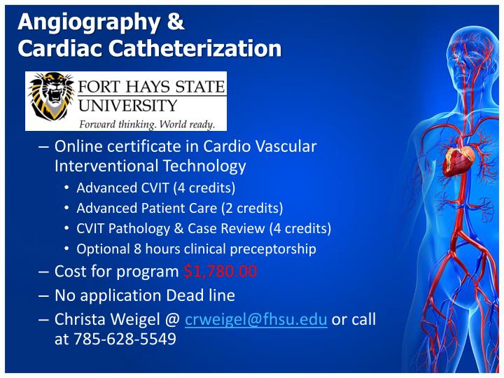 angiography cardiac catheterization20 n