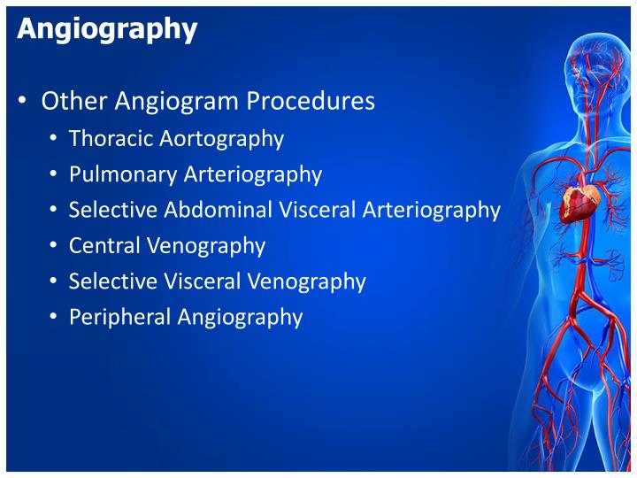 angiography coding
