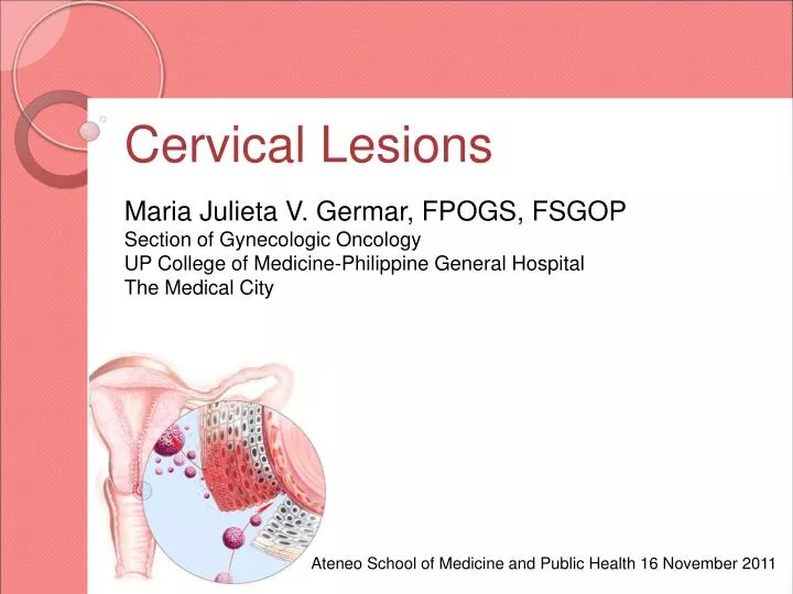 PPT Cervical Lesions PowerPoint Presentation, free download ID4103777