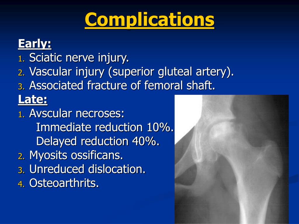 Ppt Injuries Of The Hip And Femur Powerpoint Presentation Free