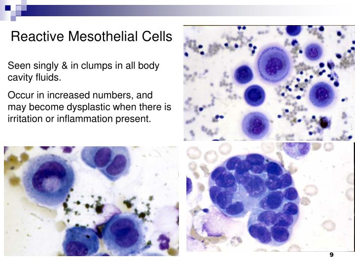 Ppt analysis of body cavity fluids powerpoint presentation id 4125931
