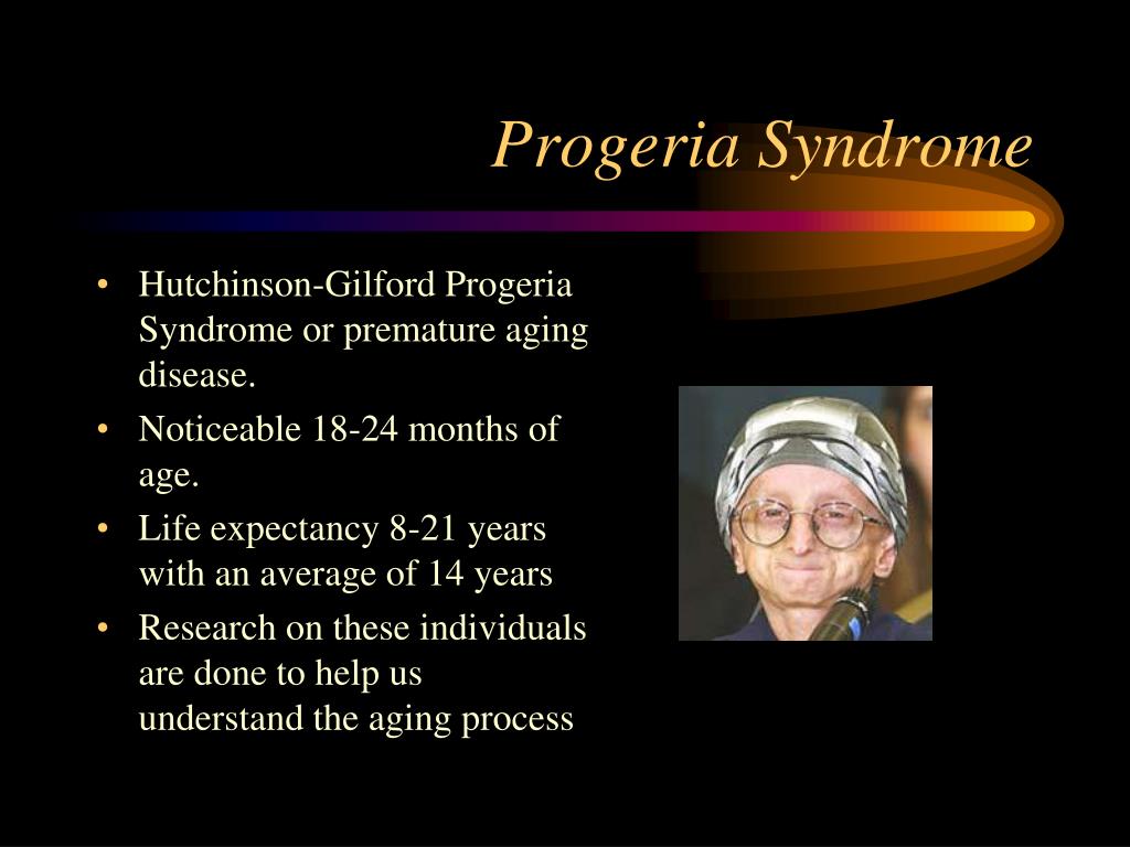 Ppt Human Genetic Disorders Powerpoint Presentation Free