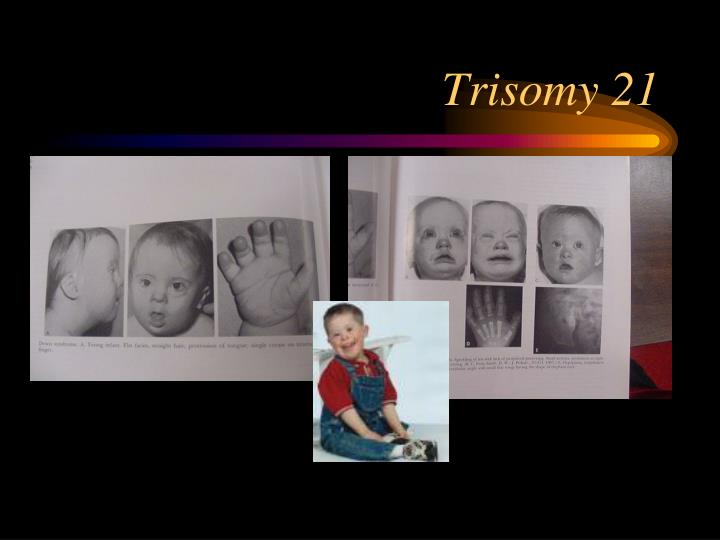 PPT Human Disorders PowerPoint Presentation ID4136462