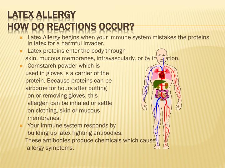 PPT LATEX ALLERGY PowerPoint Presentation ID4137033