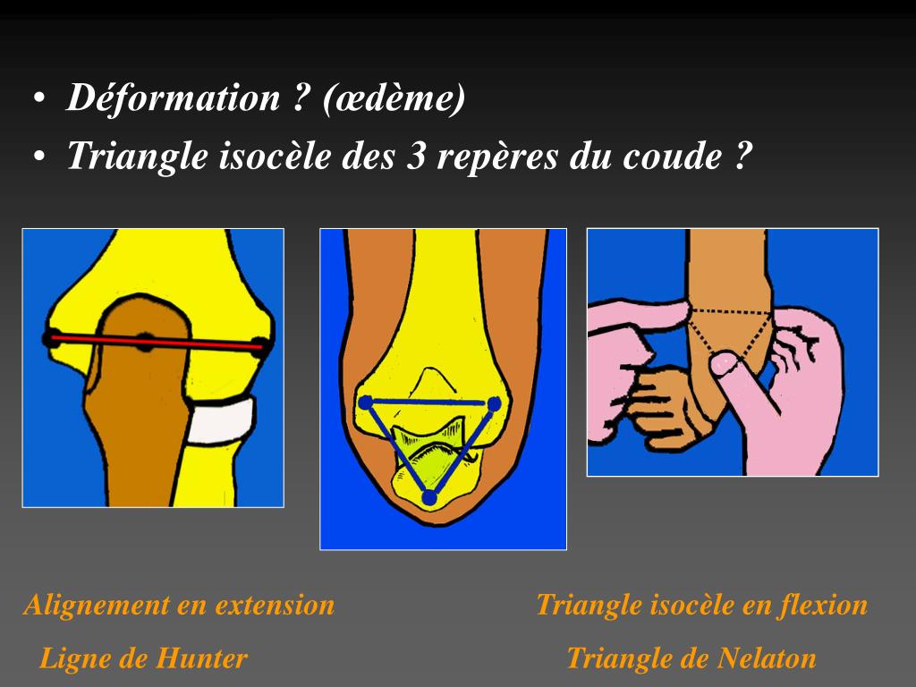 Ppt T Raumatismes D U C Oude Powerpoint Presentation Free Download Id 4137942