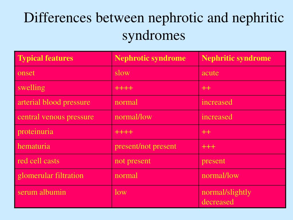 Nephrotic Vs Nephritic Table