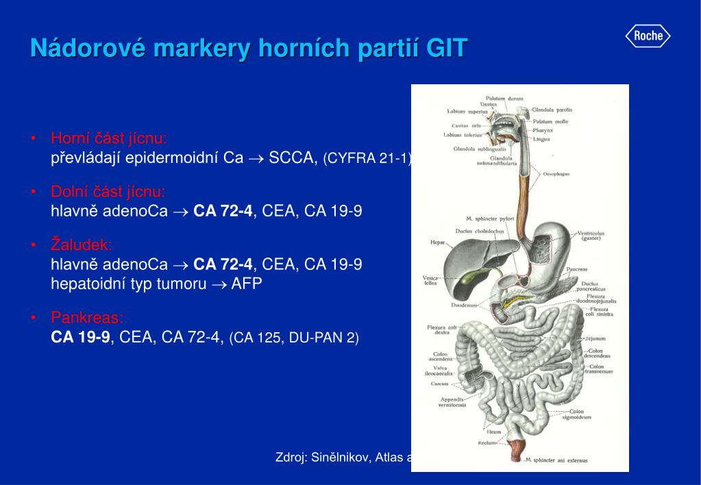 PPT - Nádorové markery tumorů horních par tií GIT PowerPoint Presentation -  ID:4146684