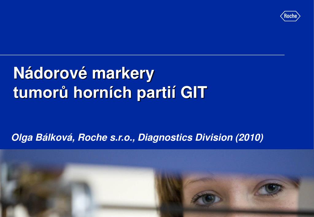 PPT - Nádorové markery tumorů horních par tií GIT PowerPoint Presentation -  ID:4146684