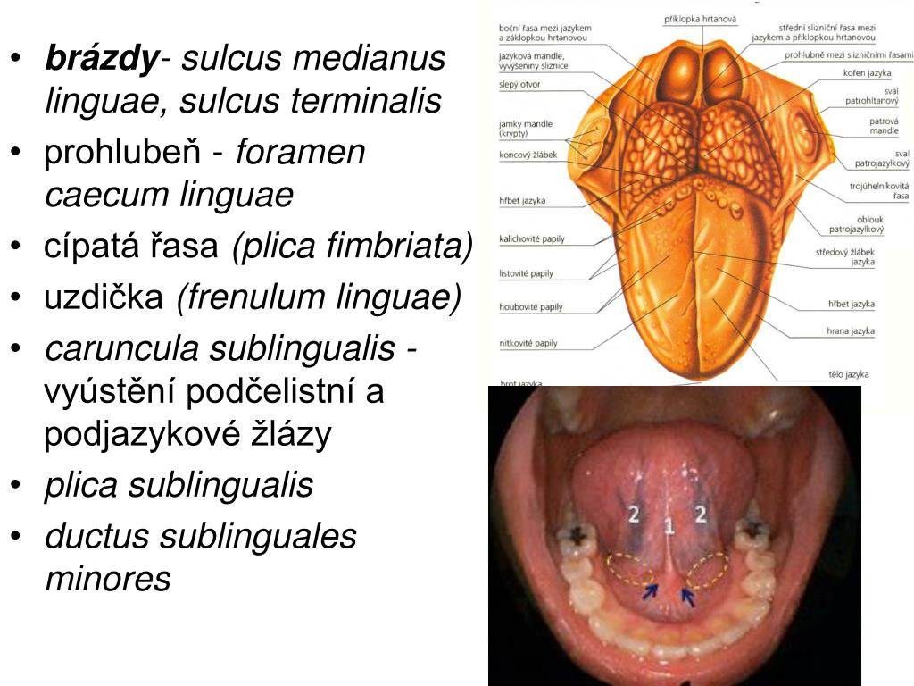 Множественное воспаление латынь. Подъязычная складка Plica sublingualis.. Caruncula sublingualis воспаление.