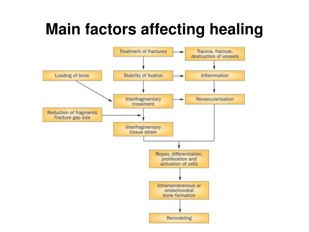 Main factors