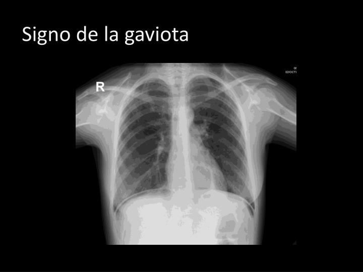 PPT - Abdomen I PowerPoint Presentation - ID:4157310