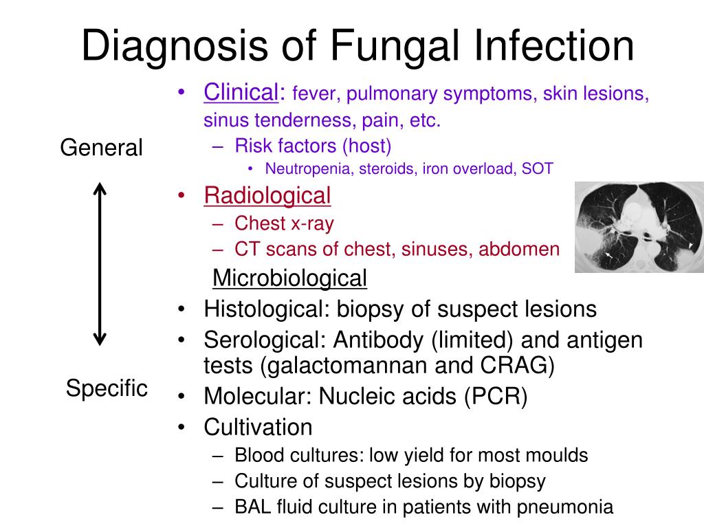 Ppt Fungi For Fellows Powerpoint Presentation Free Download Id4163423