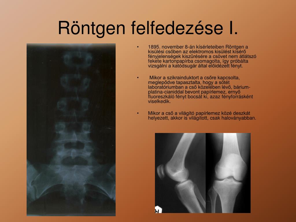 PPT - A röntgen PowerPoint Presentation, free download - ID:4178137