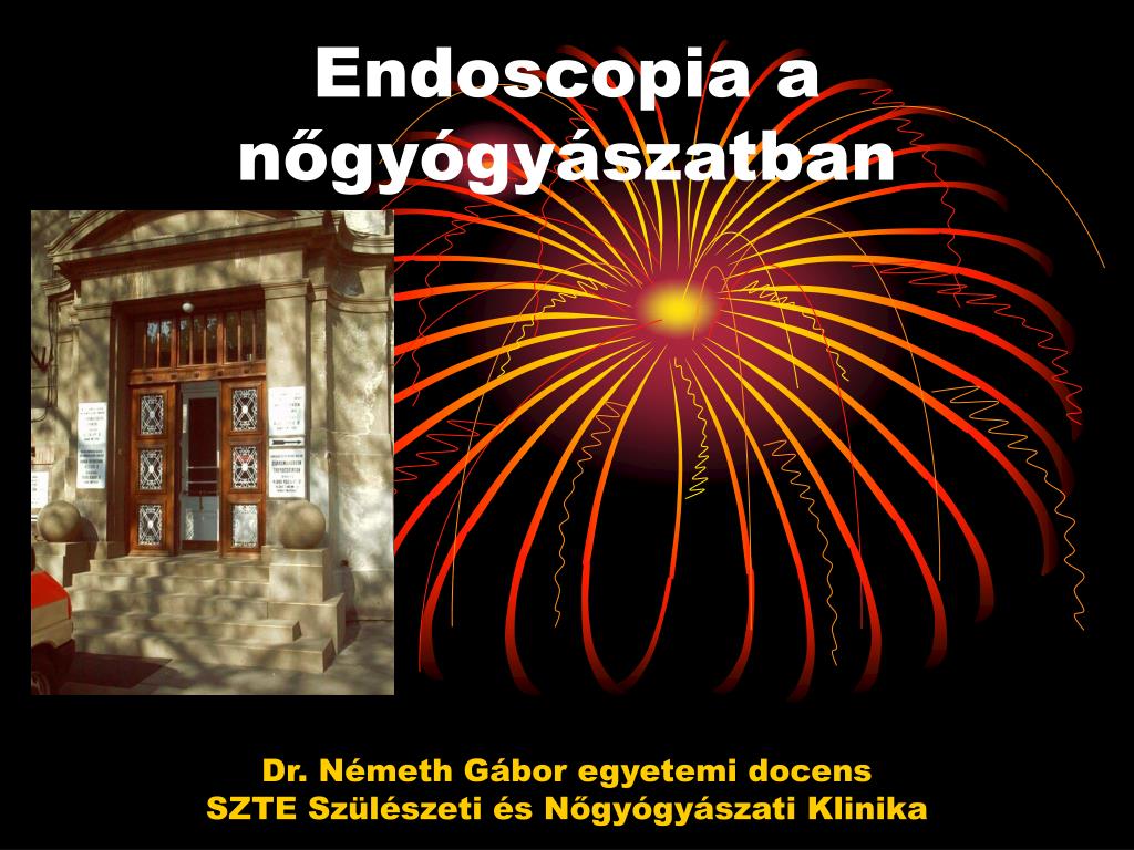 PPT - Endoscopia a nőgyógyászatban PowerPoint Presentation, free download -  ID:4187099