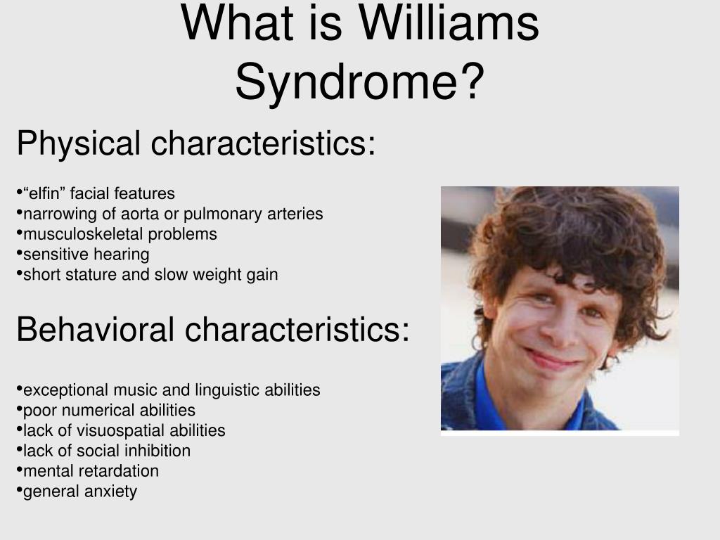Williams Syndrome Genetics