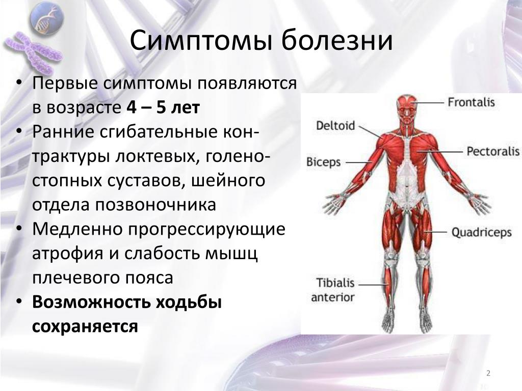 Болезнь слабости мышц. Симптомы заболевания мышц. Заболевание мышечной системы название.