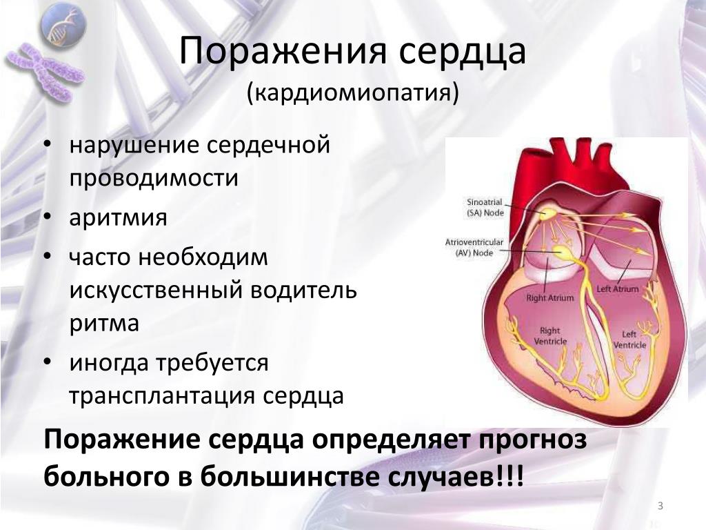 Нарушение проводимости сердца. Нарушения сердечной проходимости. Проявления нарушения проводимости сердца.