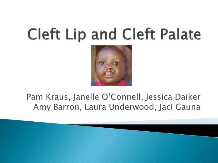Bilateral Cleft Lip Repair Ppt Klaudia