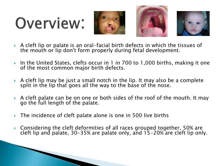 an overview of the facial birth defects of cleft lip and palate Birth defects are reported as birth but most babies with a cleft lip also have a cleft palate characteristic facial features, and often heart defects and. an overview of the facial birth defects of cleft lip and palate Birth defects are reported as birth but most babies with a cleft lip also have a cleft palate characteristic facial features, and often heart defects and.