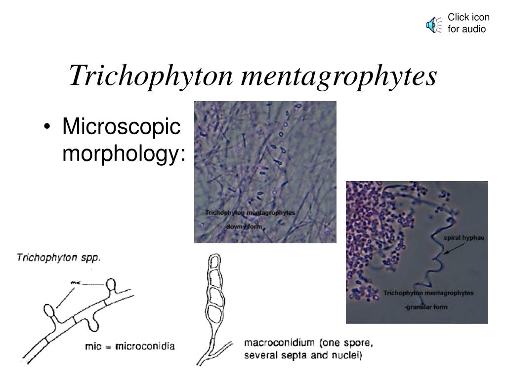 PPT - Mycology Dermatophytes PowerPoint Presentation, free download ...