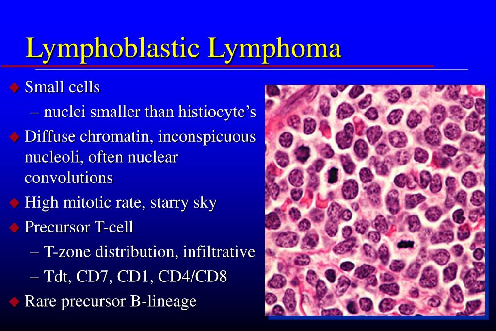 clinical presentation of lymphoma