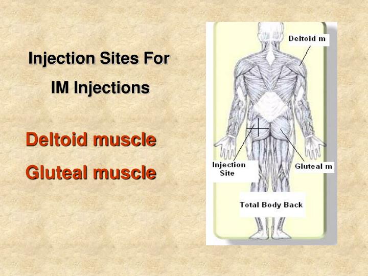 PPT Different Sites of Injections PowerPoint Presentation ID4219667