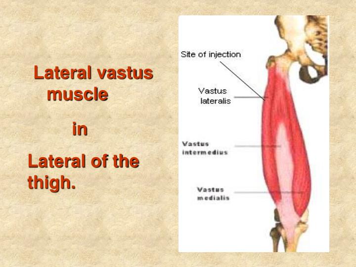 PPT - Different Sites of Injections PowerPoint Presentation - ID:4219667