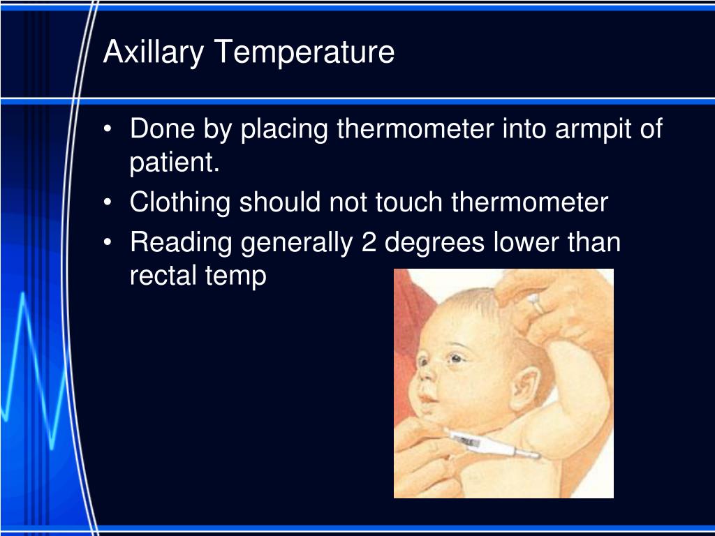 PPT Vital Signs PowerPoint Presentation Free Download ID 4224949 PPT Vital Signs PowerPoint Presentation Free Download ID 4224949